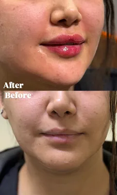 مرکز شیرینگ لب در فردیس
