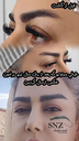 کاشت ابرو در شیراز