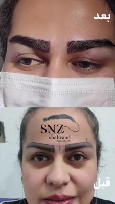 کاشت ابرو شیراز ساناز شهوند