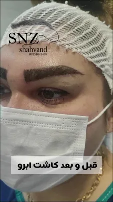 بهترین کاشت ابرو در شیراز