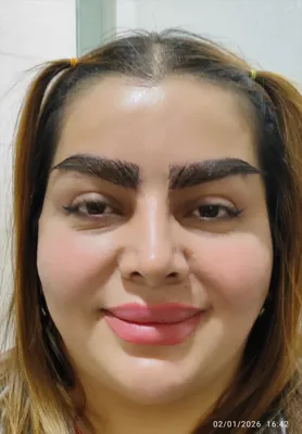 کاشت مو اقساطی در اصفهان