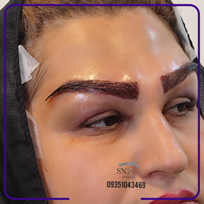 کاشت ابرو خواب طبیعی دراصفهان