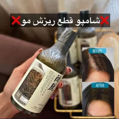 شامپو رزماری ضدریزش مو بیوآکوا اصلی باعث کاهش ریزش مو، تقویت کننده مو وضد خارش، از بین برنده چربی مو، نرم کننده و ترمیم کننده موهای خشک و آسیب دیده و درخشان کننده مو می باشد.