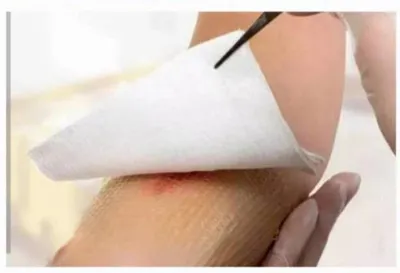 خدمات پرستاری و تزریقات منزل شاهین شهر&nbsp;