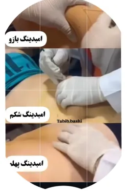 .