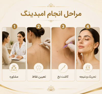 در مراحل امبدینگ، پس از بررسی و انتخاب نقاط درمانی، نخ‌های قابل جذب در نواحی مشخص قرار داده می‌شوند.