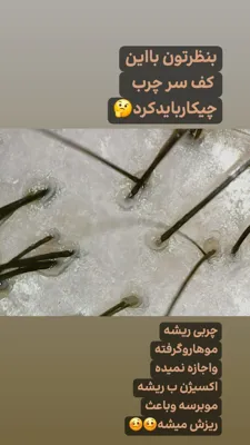 فر دائم مو در خمینی شهر