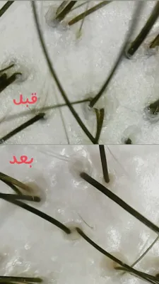 فر دائم مو در خمینی شهر 