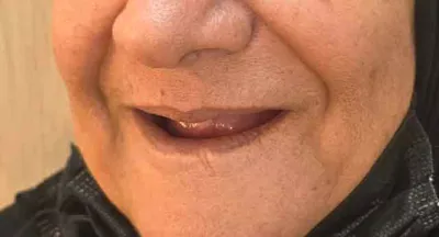 دندان سازی مکاریان