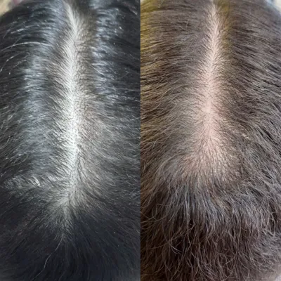 پاکسازی کف سر در مازندران