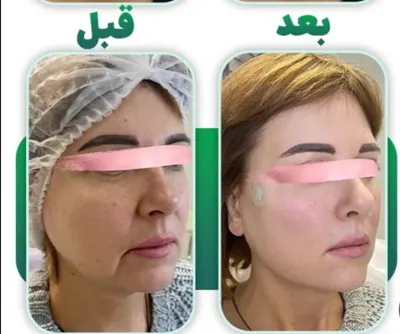 بهترین خدمات زیبایی زنانه در اندرزگو