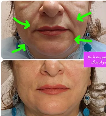بهترین خدمات زیبایی زنانه در اندرزگو