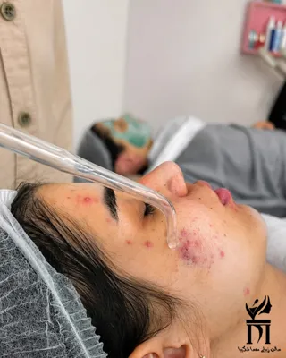 پاکسازی صورت