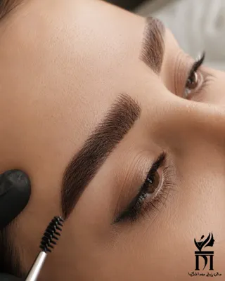 میکرو بلیدینگ