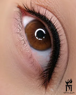 بن مژه