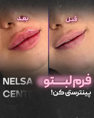بهترین مرکز لاغری و امبدینگ اصفهان