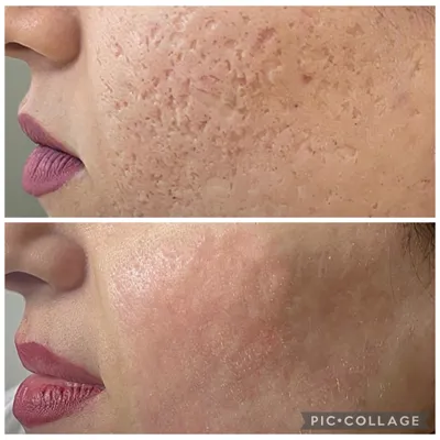 بهترین مرکز لاغری و امبدینگ اصفهان