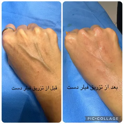 بهترین مرکز لاغری و امبدینگ اصفهان