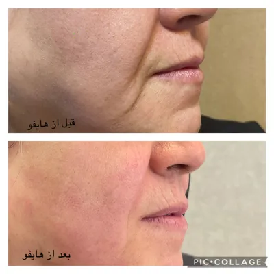 بهترین مرکز لاغری و امبدینگ اصفهان