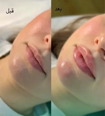 بهترین مرکز لاغری و امبدینگ اصفهان