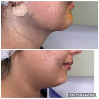 بهترین مرکز لاغری و امبدینگ اصفهان