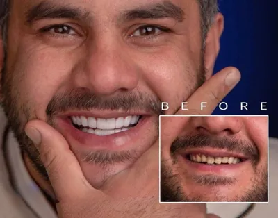 ابتسامة