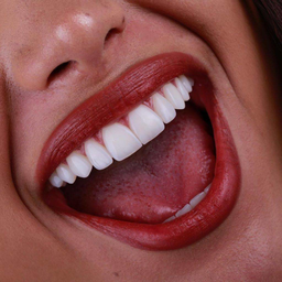 دندان پزشکی در تبریز