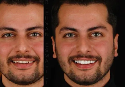 دندانپزشکی اقساطی تبریز
