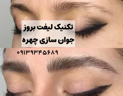 تکنیک بروز جوانسازی چهره&nbsp;
