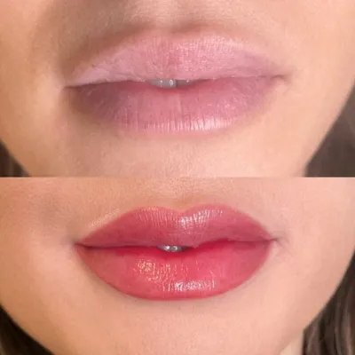 شیدینگ لب حرفهای در سعادت اباد تهران