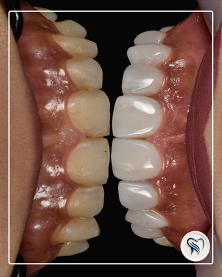 دندانپزشکی اقساطی در اصفهان