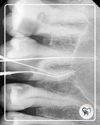 بهترین دندانپزشکی اقساطی در اصفهان