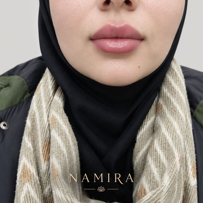 نمونه کار جدید خدمات زیبایی صورت در نارمک تهران
