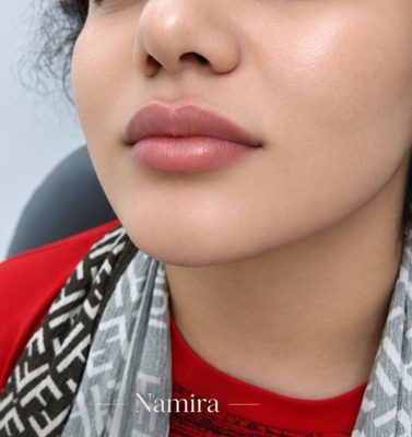 نمونه کار جدید فرم‌دهی و زیبایی چهره در نارمک
