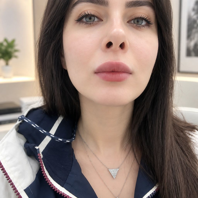 نمونه کار جدید تزریق ژل و بوتاکس در شرق تهران