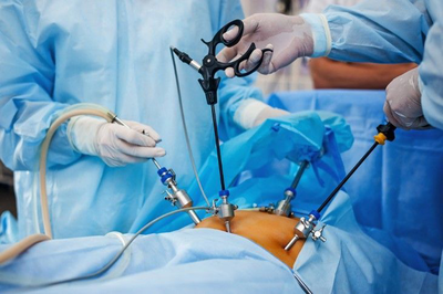 تعمیر سیستم لاپاراسکوپی