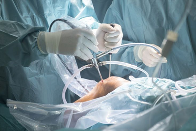 خرید سیستم آرتروسکوپی در تهران