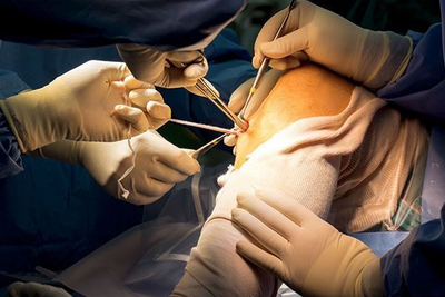 تعمیر سیستم ارتروسکوپی